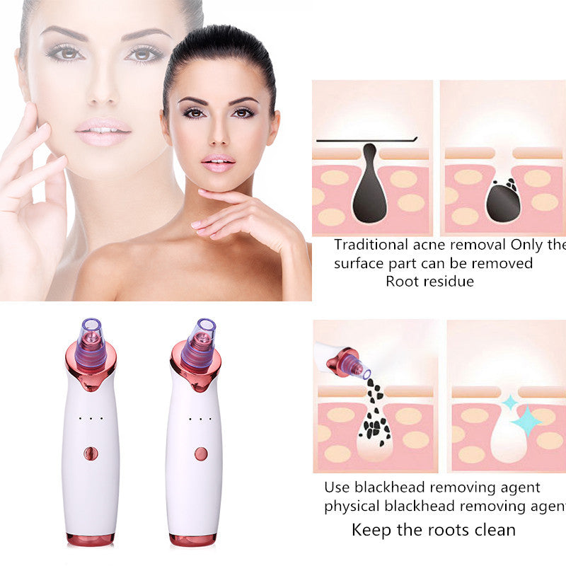 Blackhead Remover | Acne Vacuum Suction